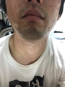 一カ月前の髭