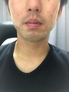 今日の肌